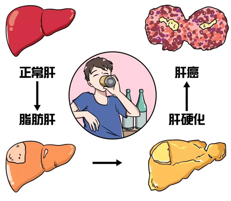 肝癌不及时治疗的严重后果 (肝癌不及时治疗会怎样)