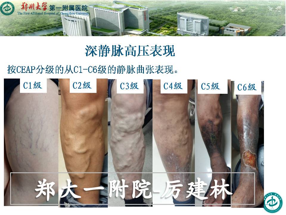 降低