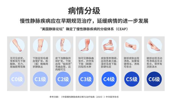静脉曲张CHIVA治疗的术后抗凝与深静脉血栓预防指南 (静脉曲张chiva手术)