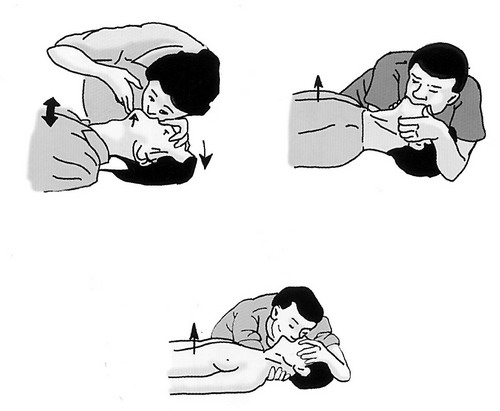 胸痛