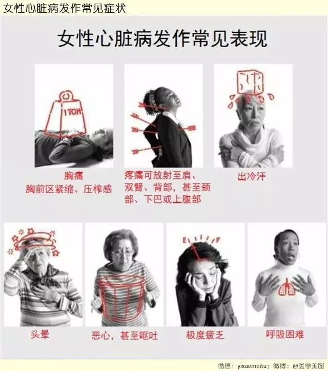 美国协会