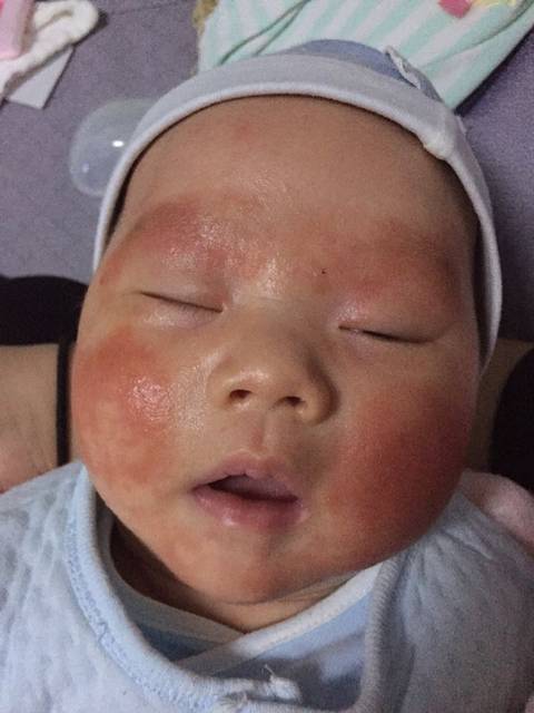 毒性