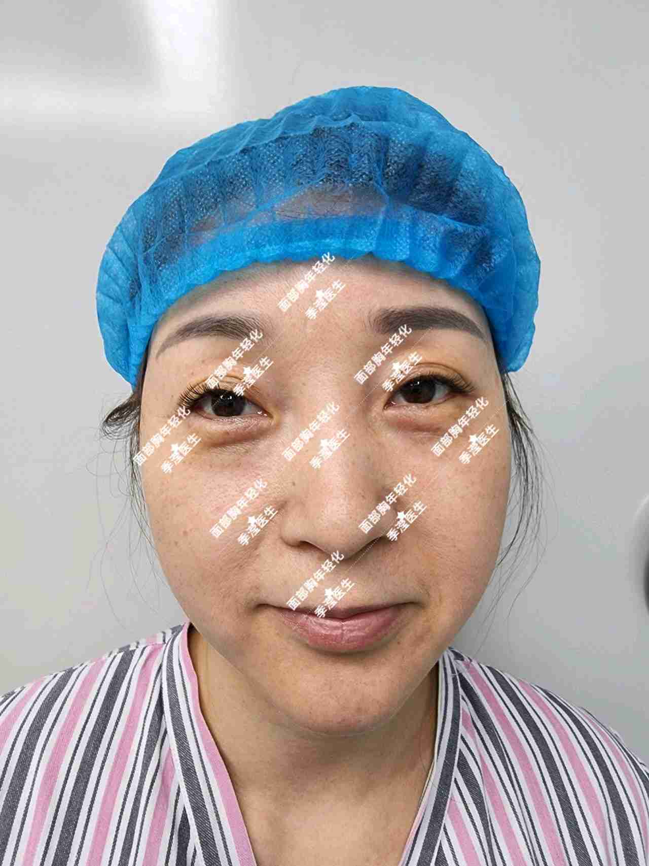 体表